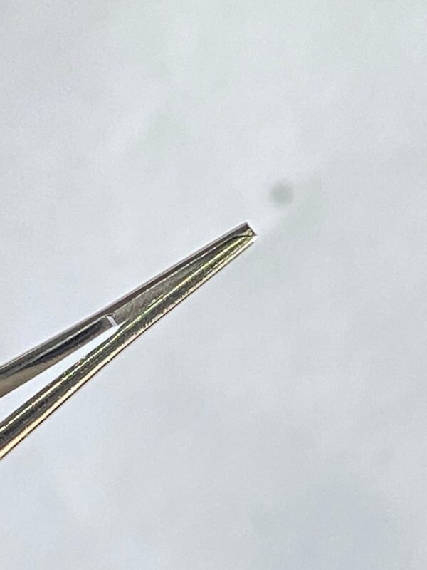 WhatsApp Image 2025-07-03 at 12.42.17 PM (2) FIXATION FORCEP TOOTH